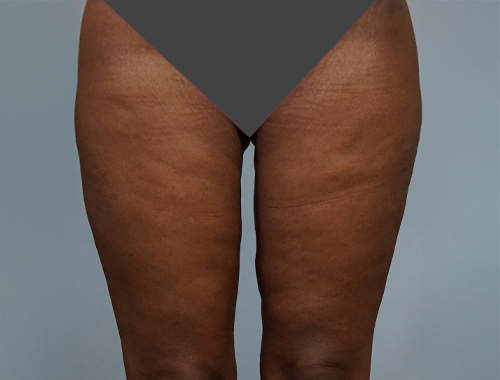 Case #739 After image