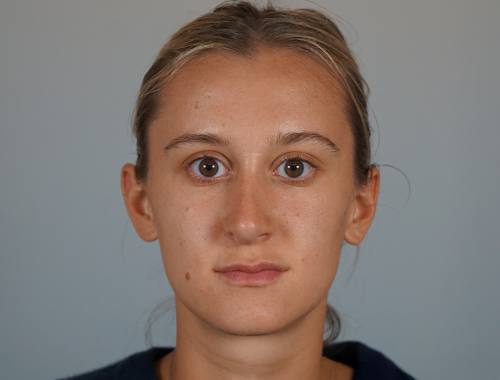 Case #742 After image