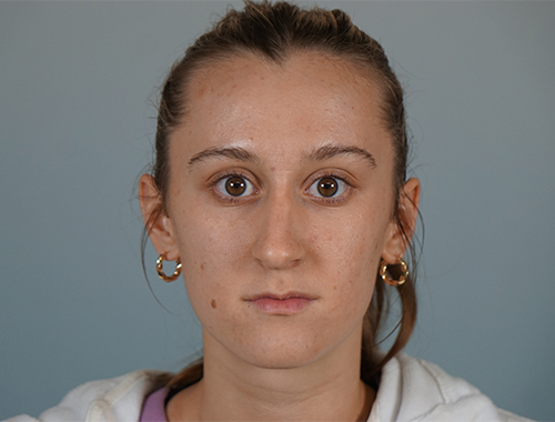Case #742 Before image