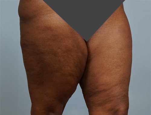 Case #739 Before image