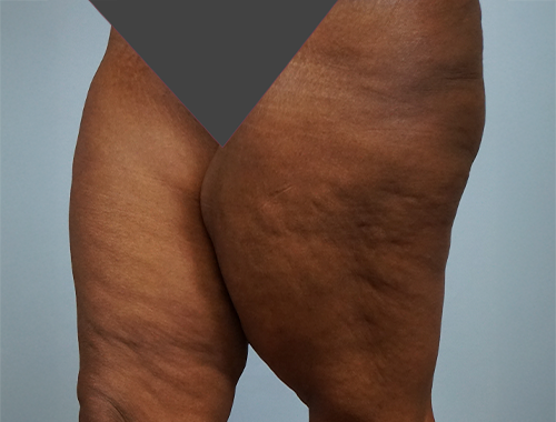 Case #739 Before image