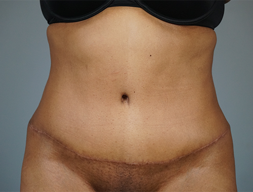 Case #745 After image