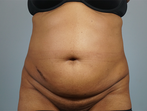 Case #745 Before image