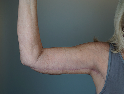 Case #748 After image