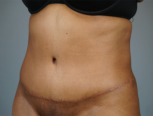 Case #745 After image