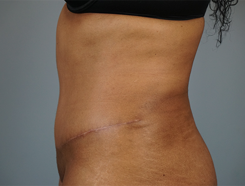 Case #745 After image