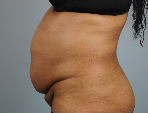Case #745 Before image