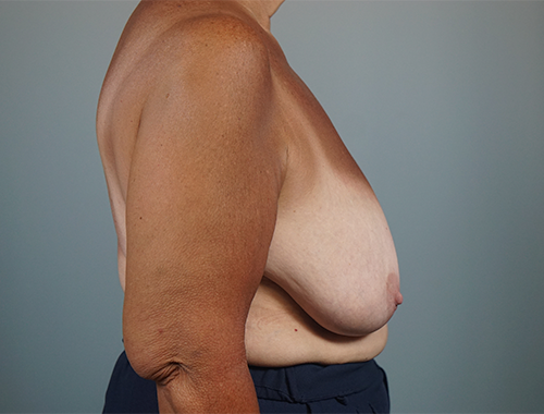Case #747 Before image