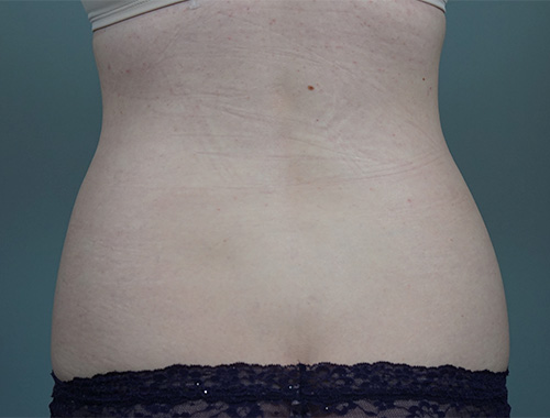 Case #757 Before image