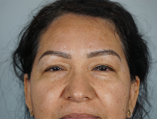 Case #753 Before image