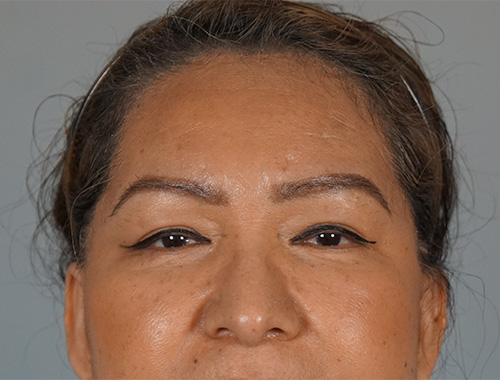 Case #750 After image