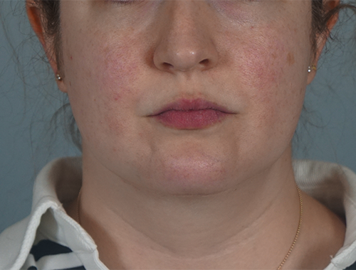 Case #759 After image