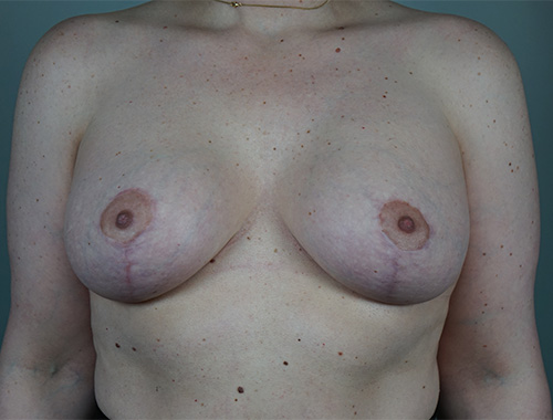 Case #751 After image
