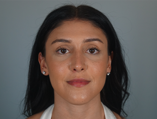 Case #763 After image