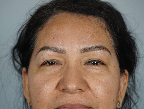 Case #750 Before image