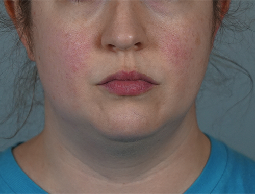 Case #759 Before image