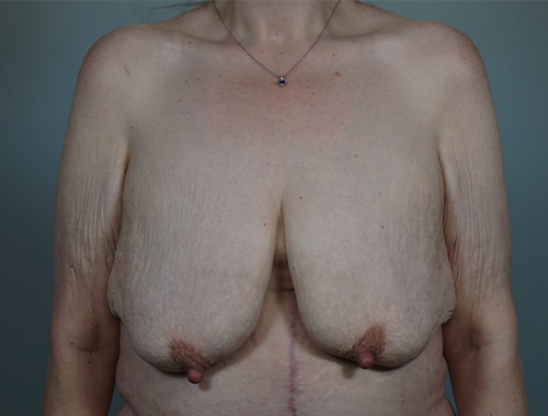 Case #760 Before image