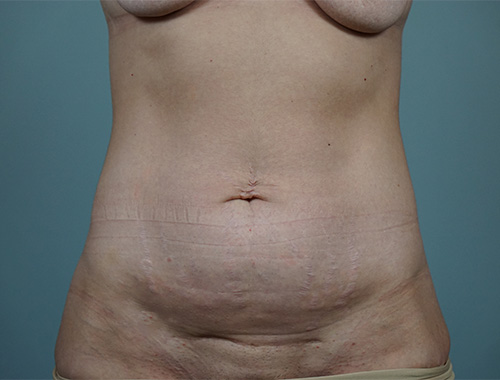 Case #754 Before image