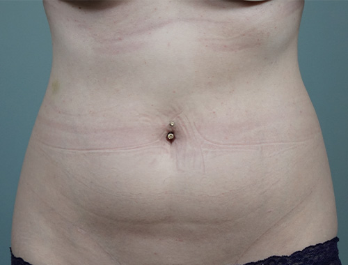 Case #757 Before image