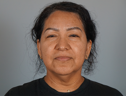 Case #753 Before image