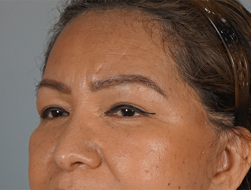 Case #750 After image