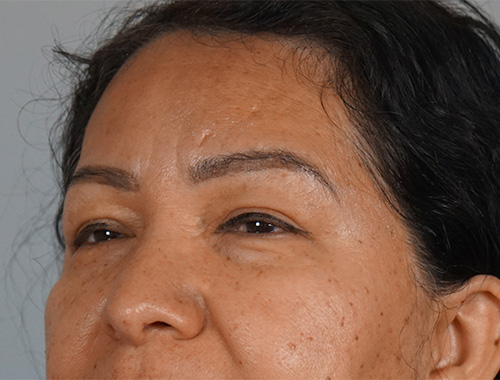 Case #750 Before image