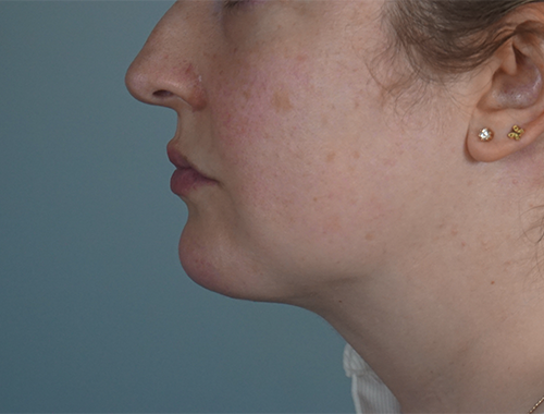 Case #759 After image