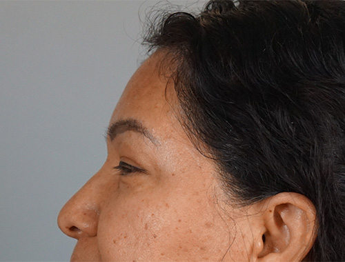 Case #750 Before image