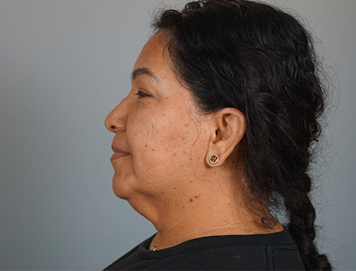 Case #753 Before image