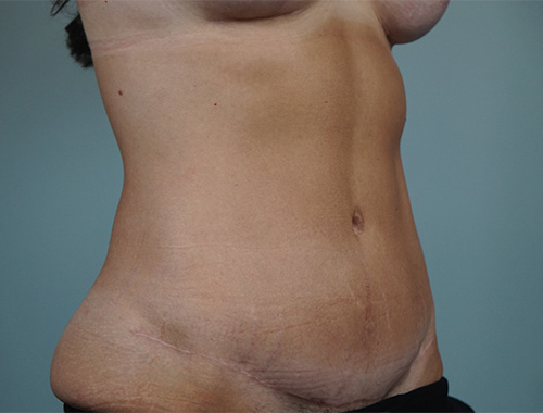 Case #754 After image