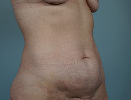 Case #754 Before image