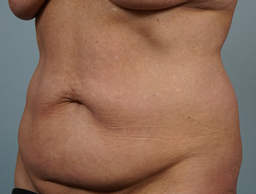 Case #749 Before image