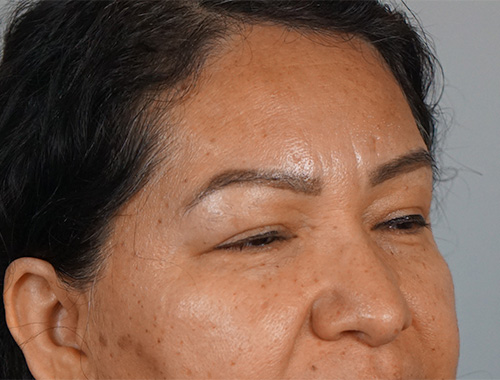 Case #750 Before image