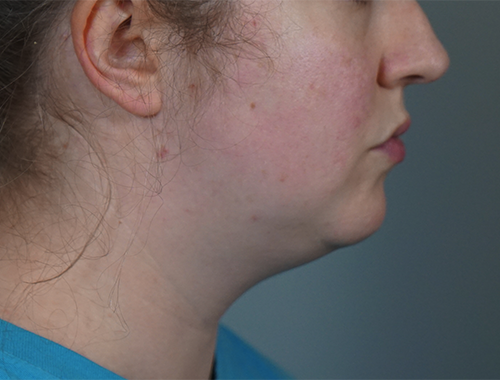 Case #759 Before image