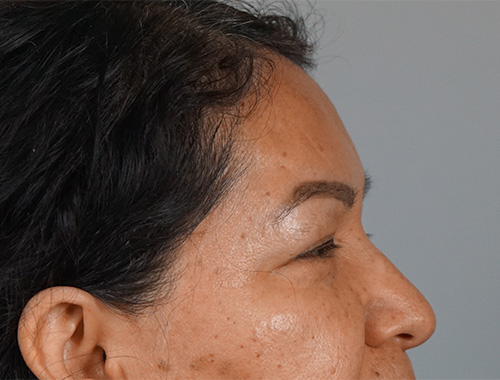 Case #750 Before image