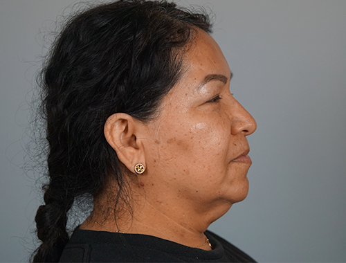 Case #753 Before image