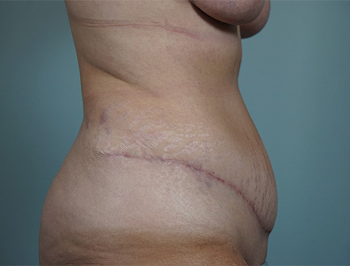 Case #752 After image