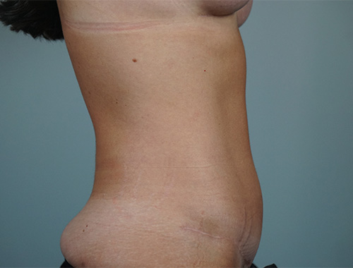 Case #754 After image