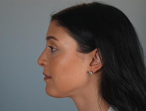 Case #763 After image