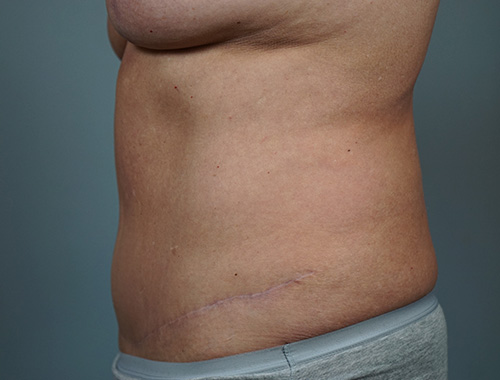 Case #749 After image