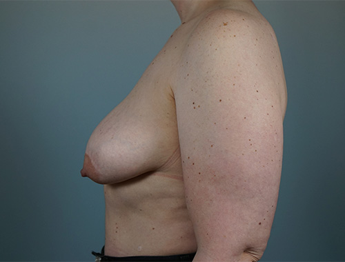 Case #751 Before image