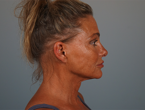 Case #761 Before image