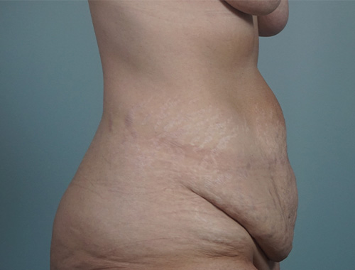 Case #752 Before image
