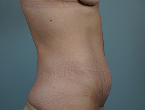 Case #754 Before image