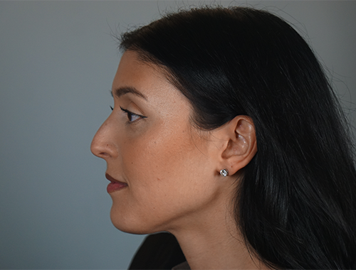 Case #763 Before image