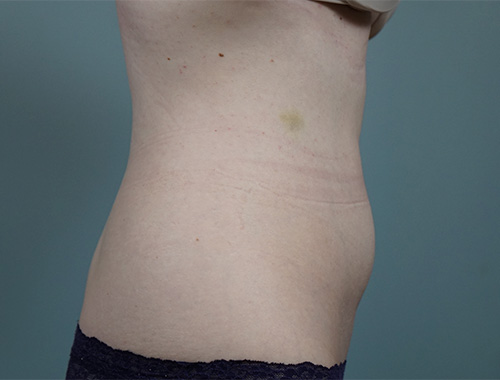 Case #757 Before image