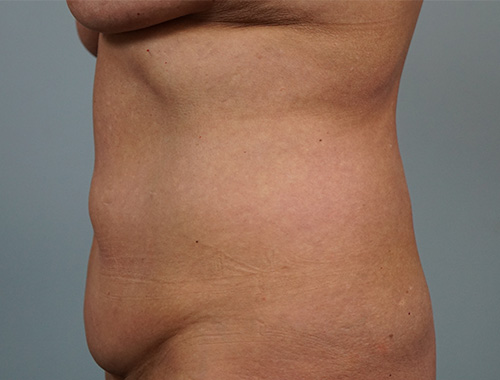 Case #749 Before image