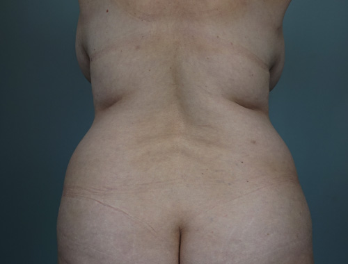 Case #765 Before image