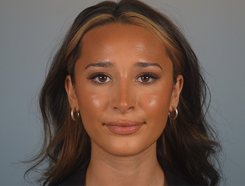 Case #768 After image