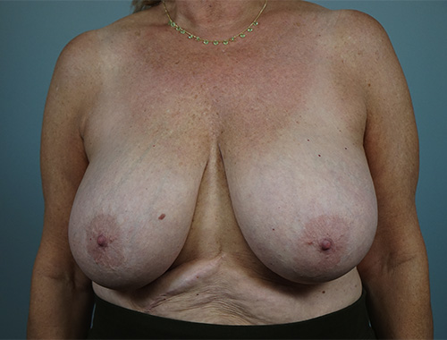 Case #766 Before image